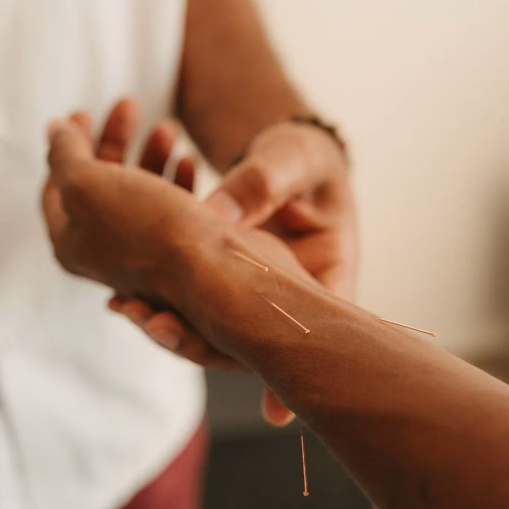 Acupuncture sur l'avant-bras